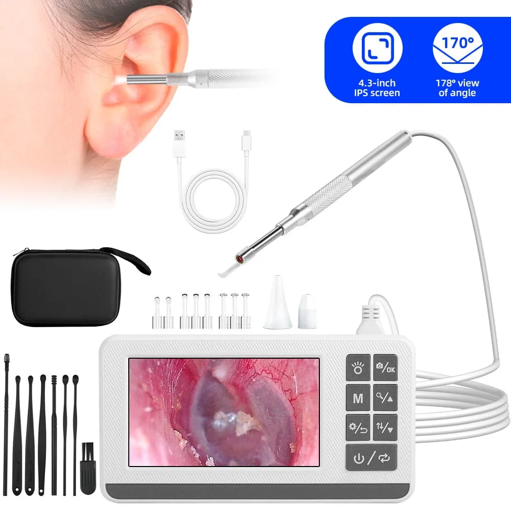 Caméra endoscopique auriculaire, écran LCD 4.3 pouces, Otoscope avec caméra auriculaire légère avec outils d'élimination du cérumen