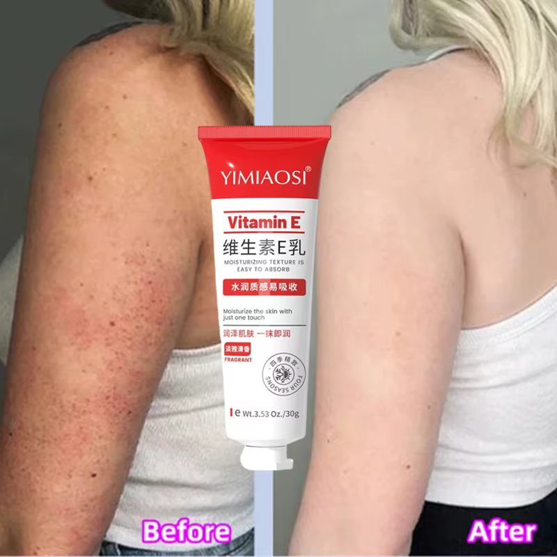 Crème Réparatrice Anti-Graine de Poule, Réduit l'Acné, Resserre les Pores, Atténue la Mélanine Corpo