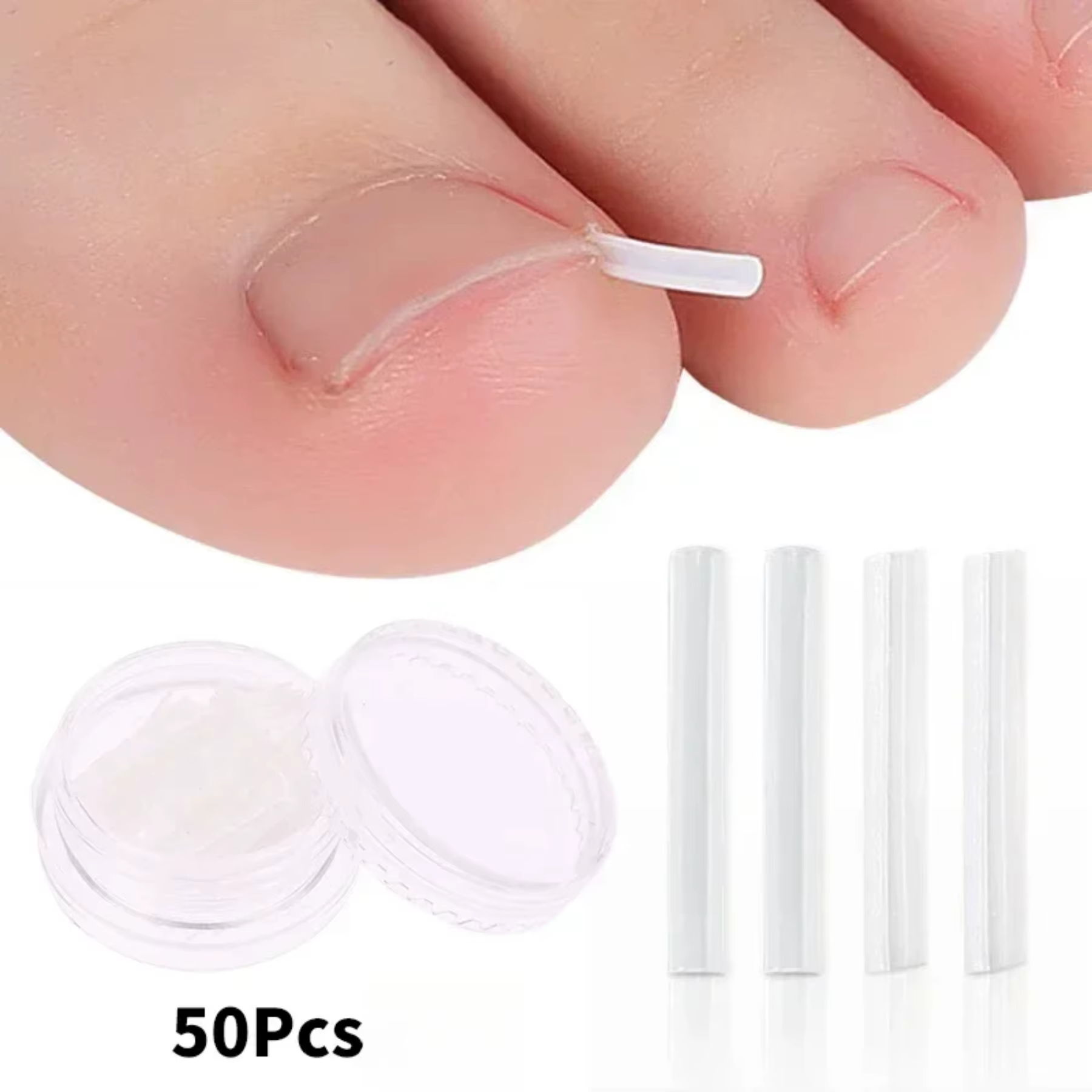 Outil pour ongles incarnés, traitement des ongles incarnés, Patch élastique autocollant, Clip de red