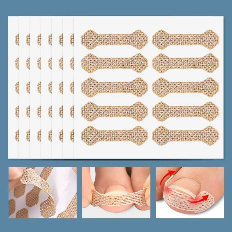 60 Bandes Correctrices Anti-Paronychie pour Ongles Incarnés, Patchs Anti-Encrochement pour Pieds, Pa