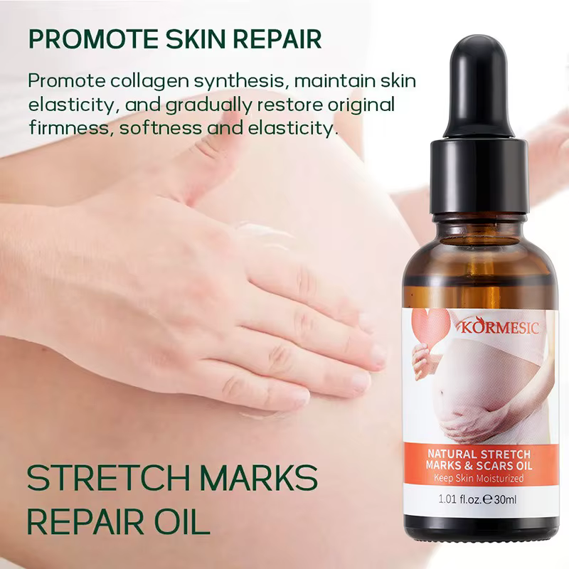 Dissolvant de vergetures, huile essentielle, grossesse, maternité, corps, nouveau vieux sérum d'élim