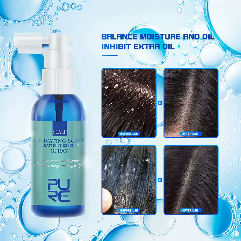 PURC-Spray de Traitement du Cuir oral elu et des Pellicules, Produit de miles, Santé, Prévenir les Démangeaisons, Contrôle de l'Huile, Sérum Anti-Perte de Cheveux, 5 Pièces