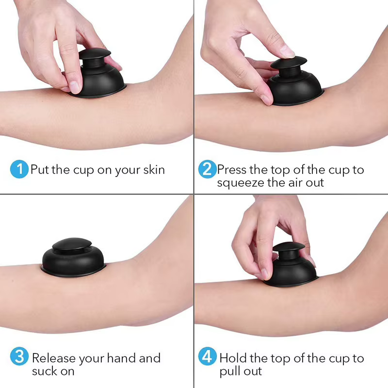 Ensembles de thérapie à ventouse Chi ping en silicone