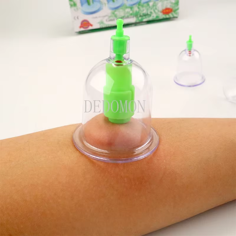 Canettes de thérapie anti-cellulite à ventouse Chi ping
