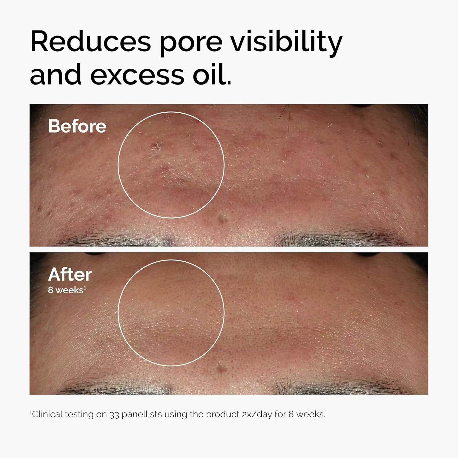 Sérum pour le visage à 10% de niacinamide et 1% de zinc