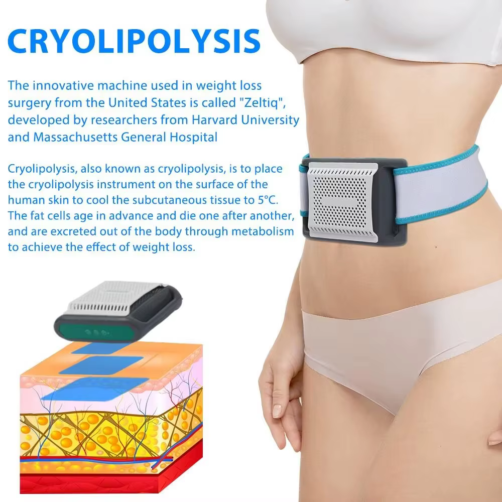 Appareil de cryolipolyse pour la congélation des graisses