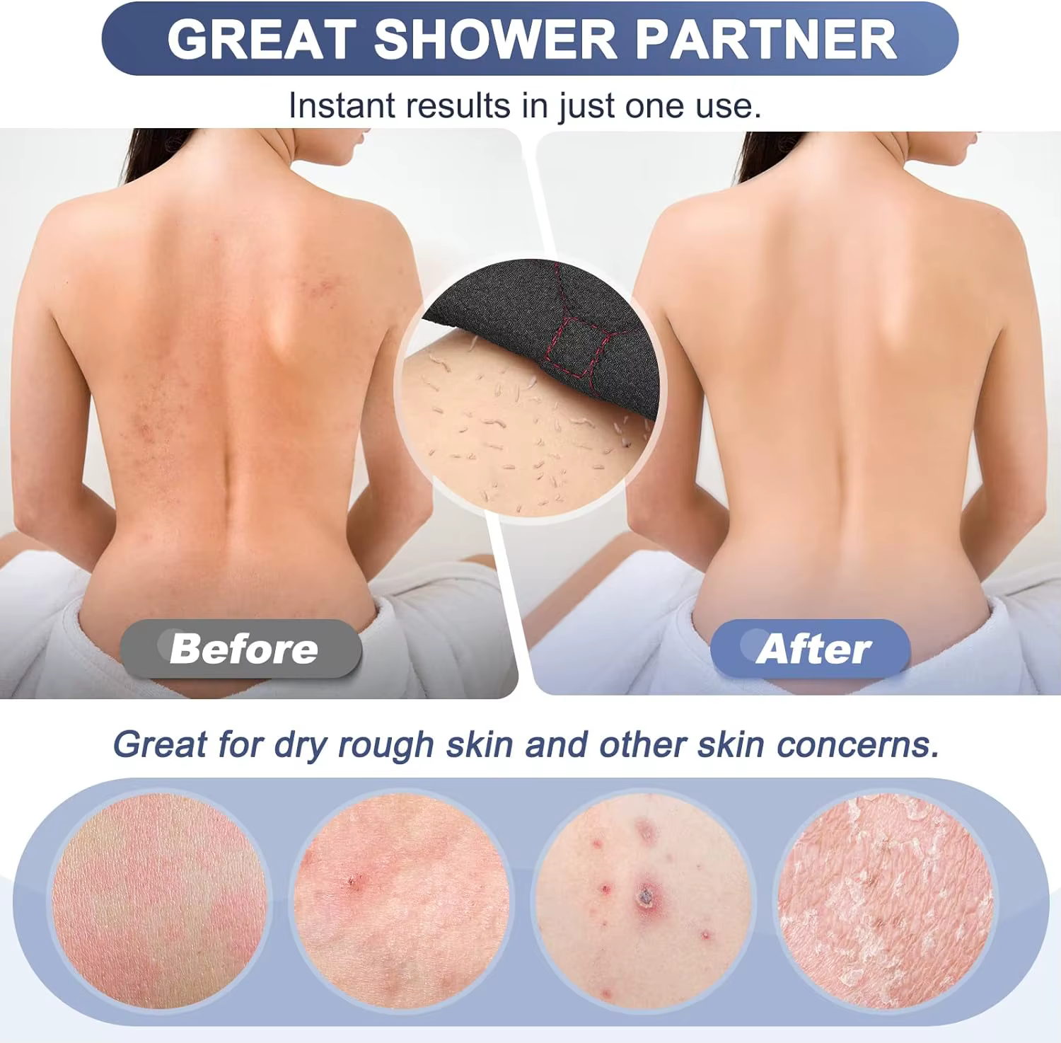 Bol exfoliant pour le dos