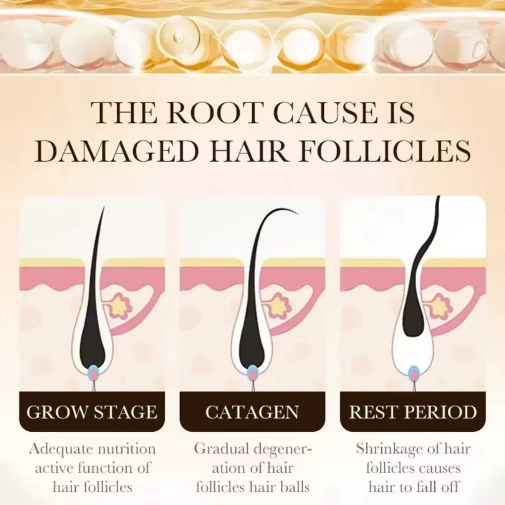 Essentiel pour la croissance des cheveux clairsemés