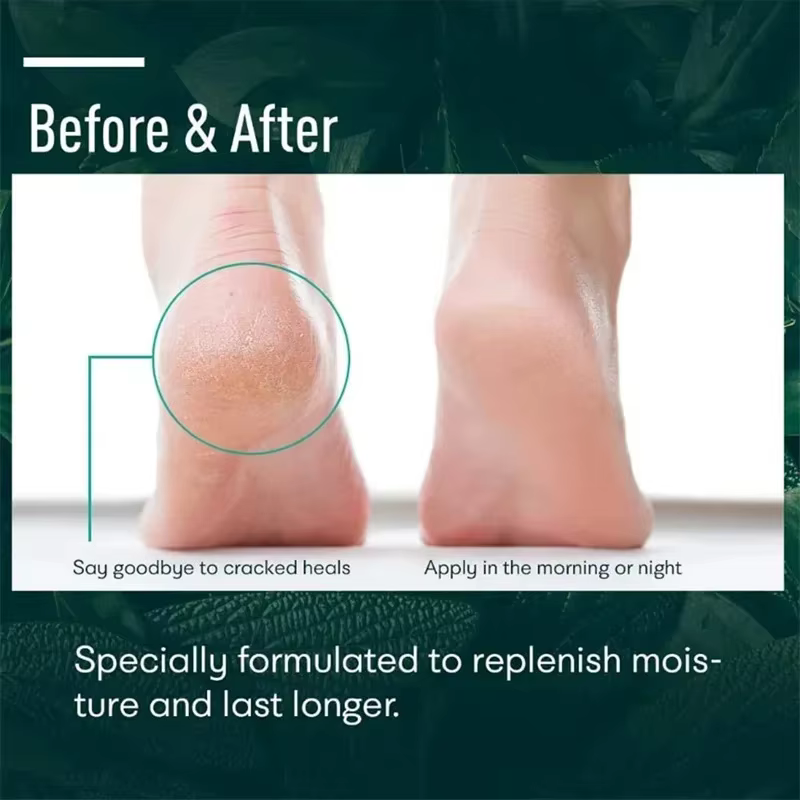 Crème Anti-fissure à base de plantes pour les pieds
