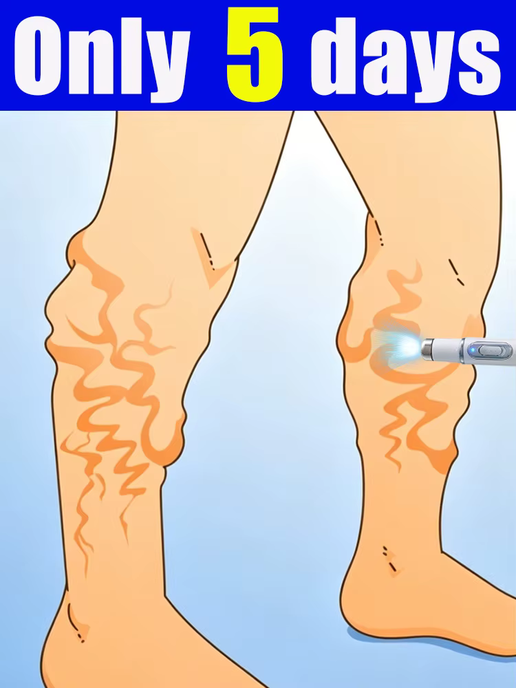 Appareils de soins des pieds et des jambes adaptés aux besoins de différents groupes