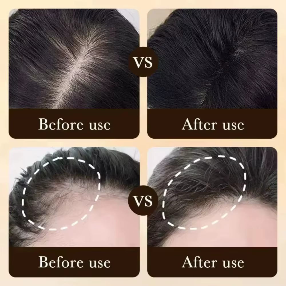 Essentiel pour la croissance des cheveux clairsemés