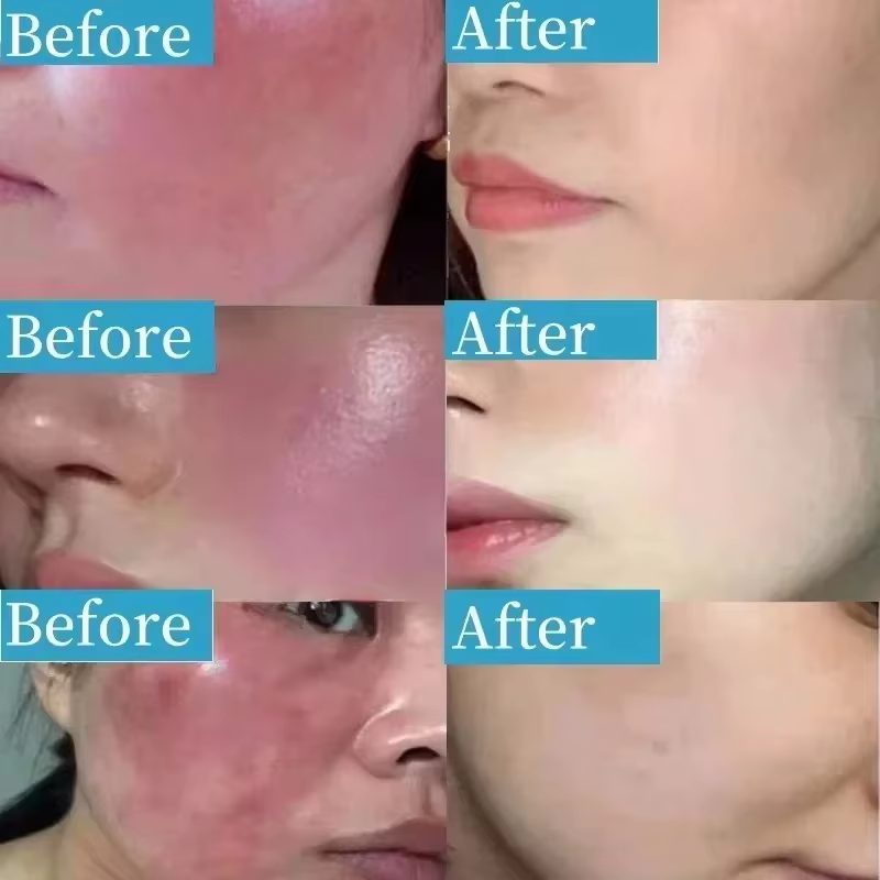 Crème réparatrice des rougeurs du visage coréenne