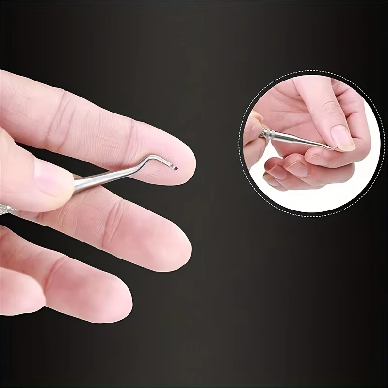 Correction professionnelle des ongles incarnés