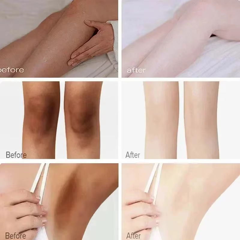 Crème blanchissante pour le corps