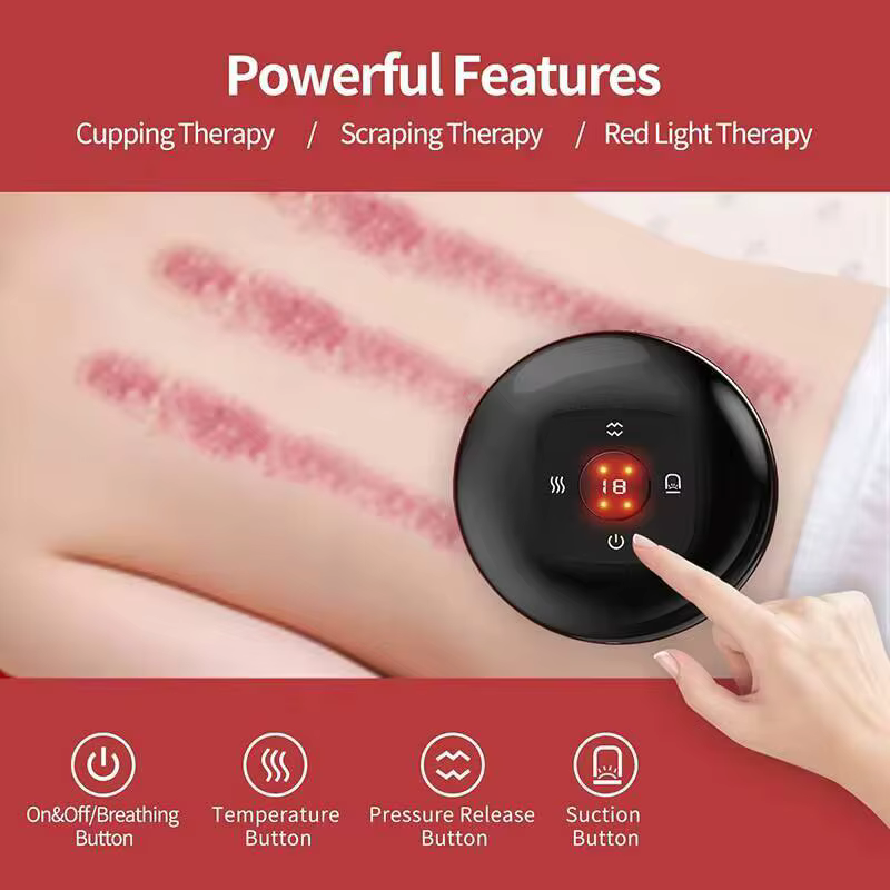 Appareil de massage intelligent par ventouses JianYouCare avec chauffage infrarouge, ventouses de guasha, anti-cellulite, brûleur de graisse, amincissant