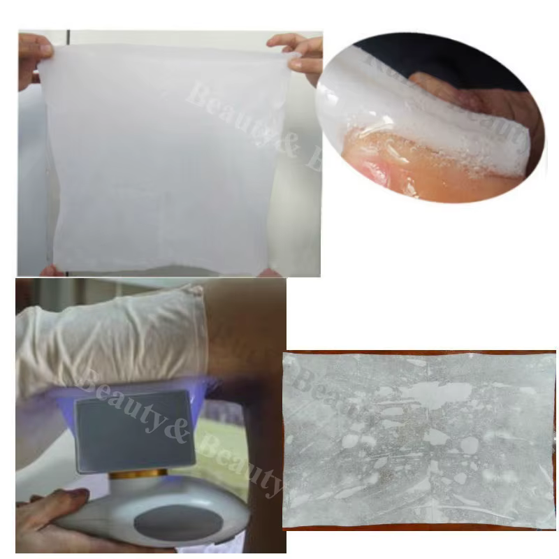 Membranes de congélation des graisses