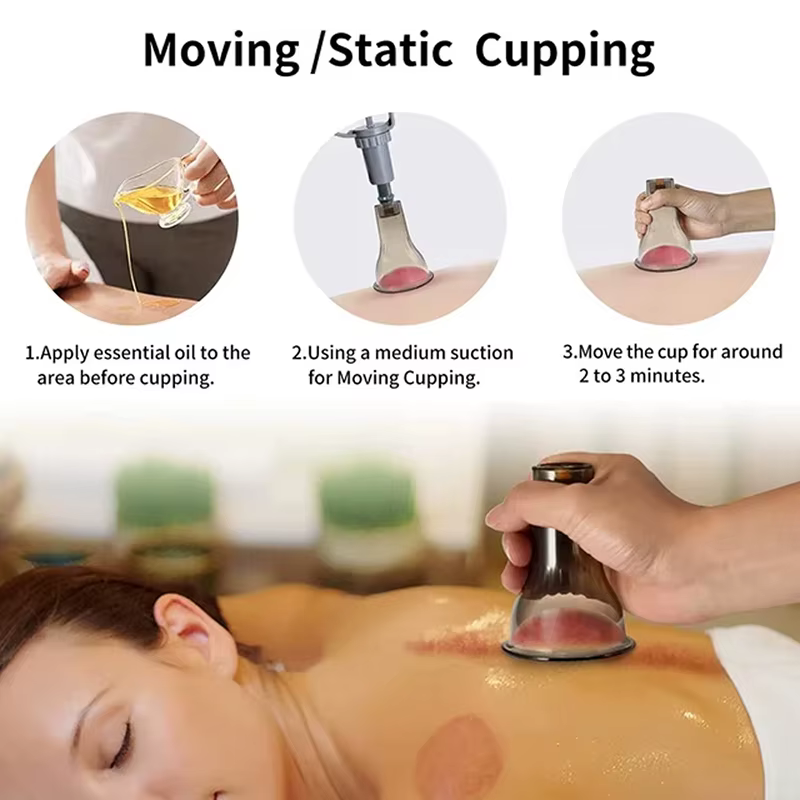Ventouses de Massage sous vide