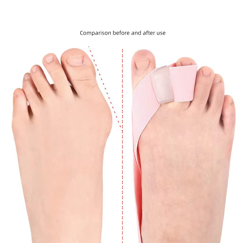 Correcteur d'hallux Valgus