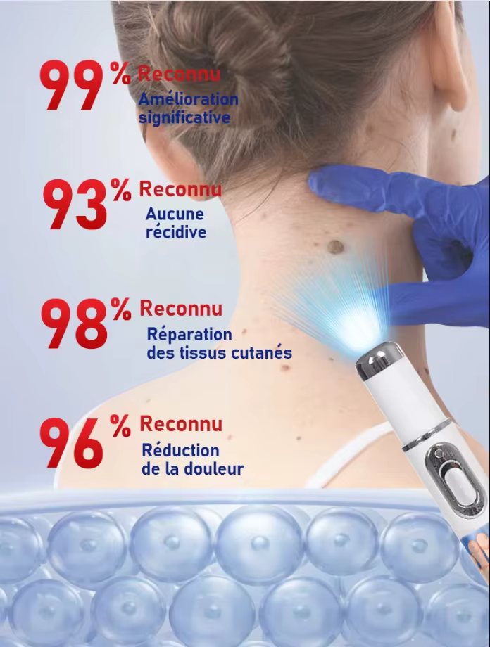 Stylo anti-verrues pour usage domestique quotidien