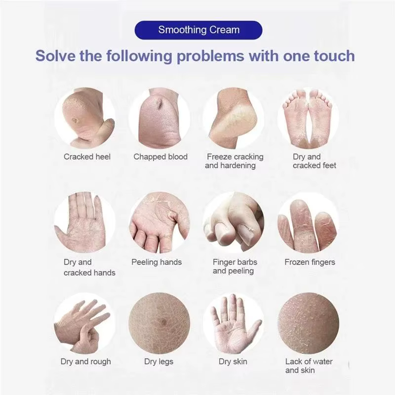 Crème anti-fissure pour les pieds