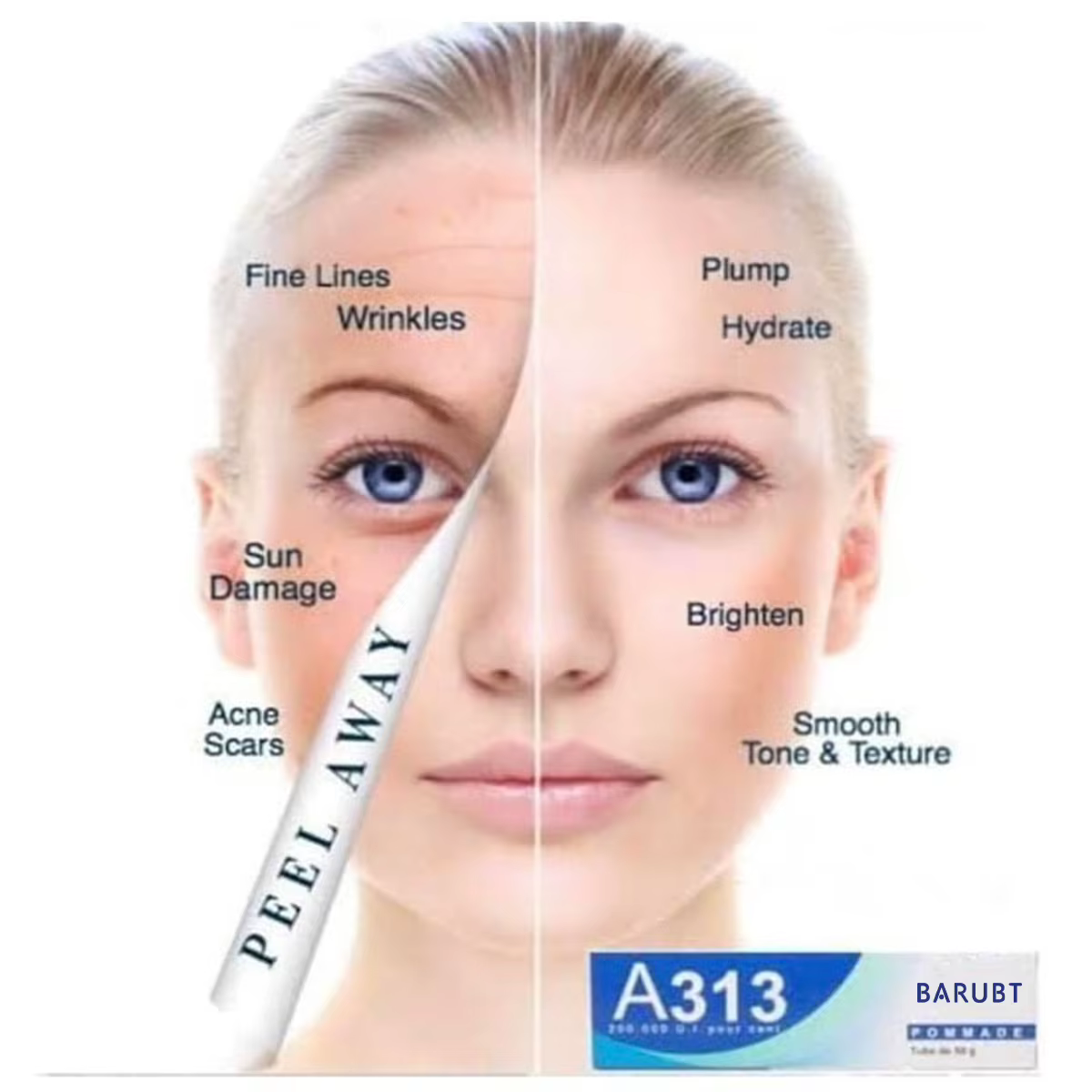 Crème au rétinol à la vitamine A A313 Resserre