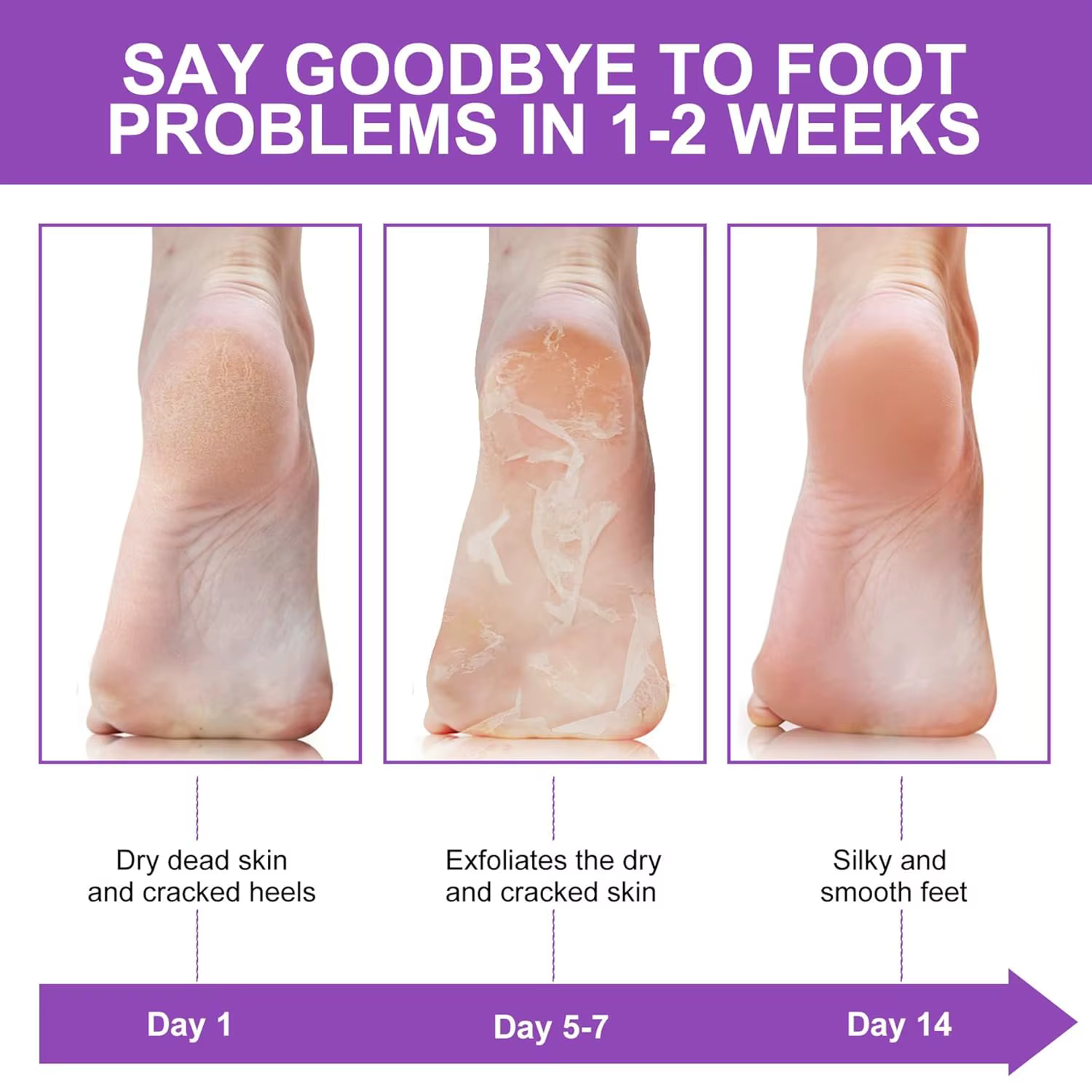 Chaussettes exfoliantes pour les pieds