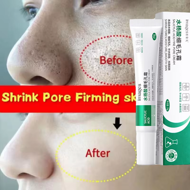 Crème de traitement à l'acide salicylique pour resserrer les pores