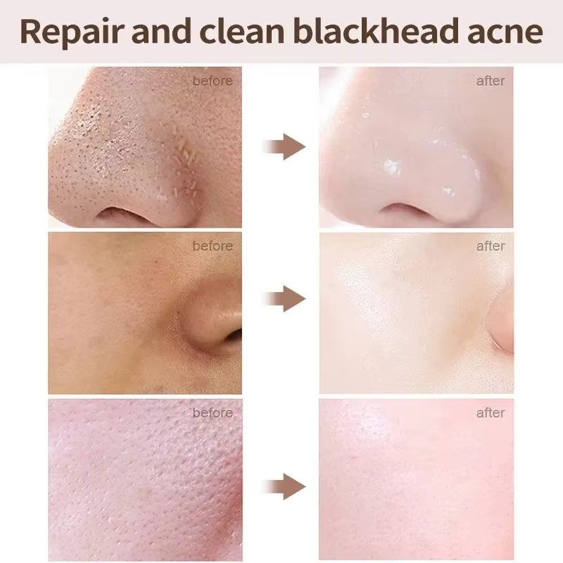 Crème de rétrécissement des pores à l'acide salicVAC