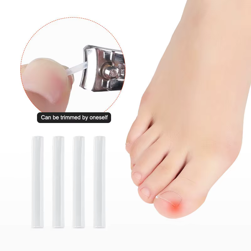 Correcteur professionnel des ongles incarnés – Autocollants de soin des pieds pour la protection