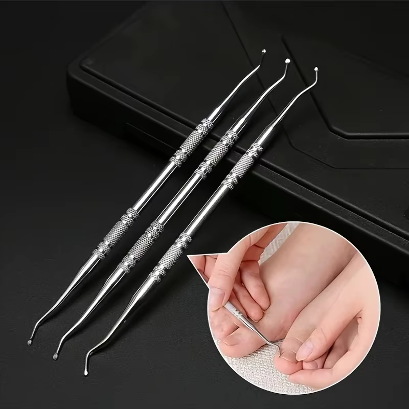 Correction professionnelle des ongles incarnés