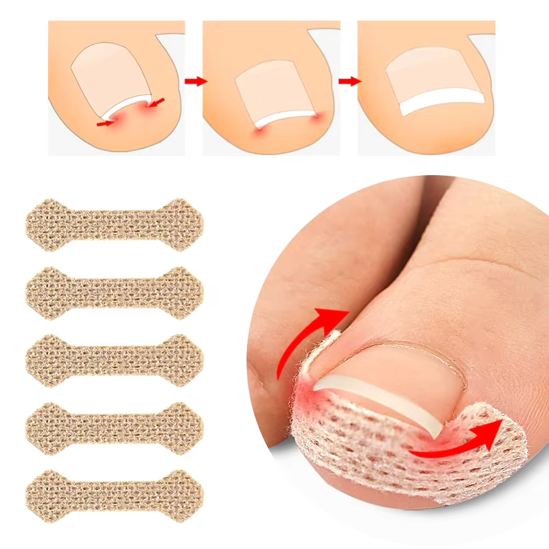60 Bandes Correctrices Anti-Paronychie pour Ongles Incarnés