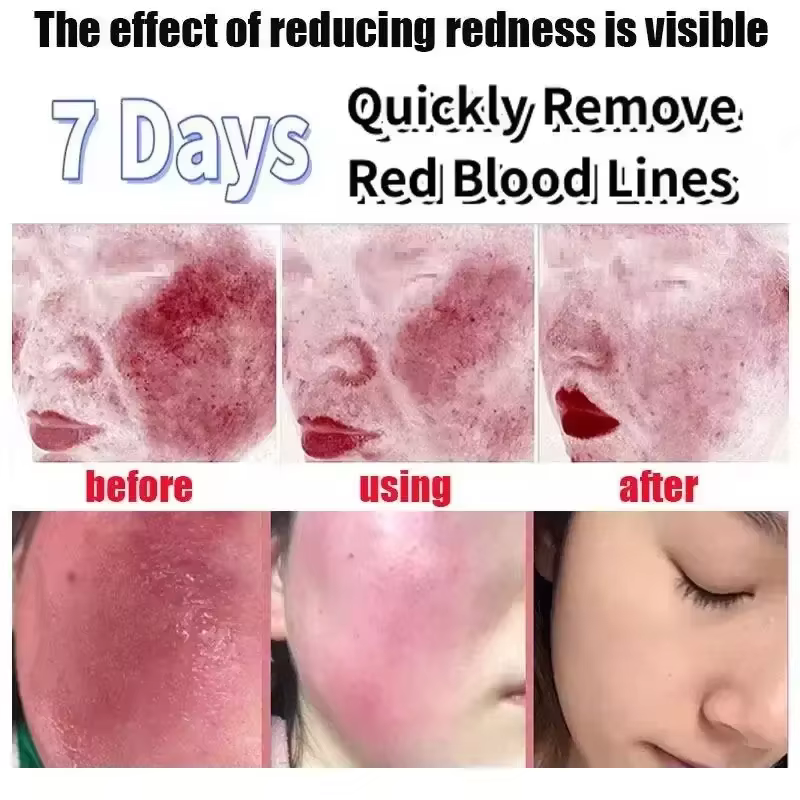 Crème réparatrice des rougeurs du visage coréenne