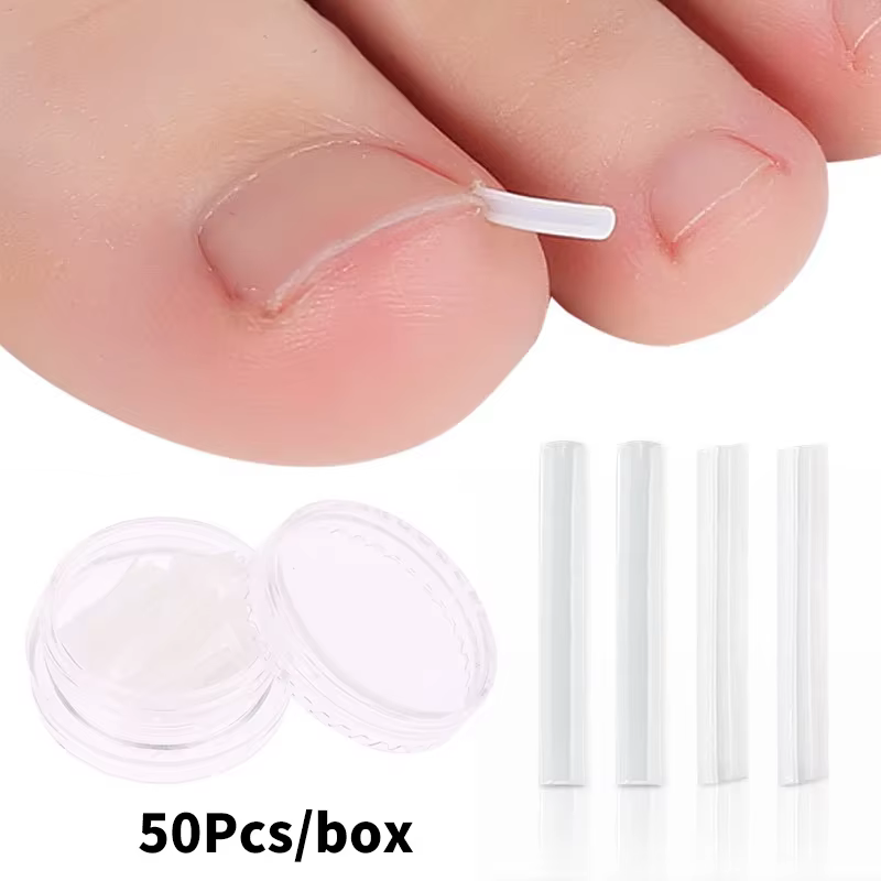 Correction des ongles des pieds