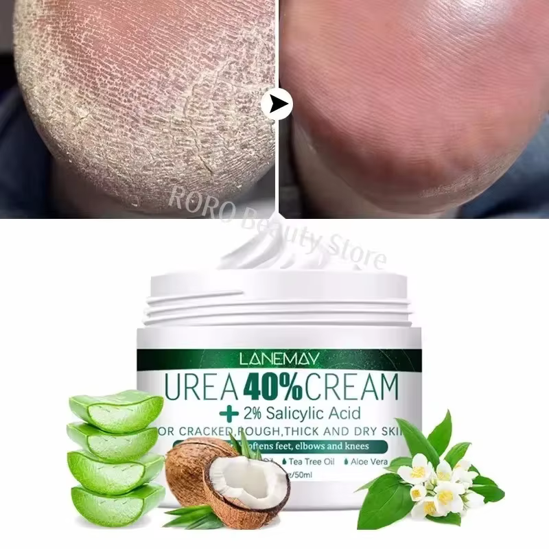 Crème Anti-fissure à base de plantes pour les pieds