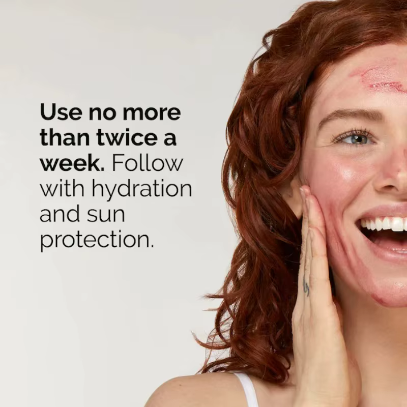 AHA 30% + BHA 2% Solution de Peeling 30ml