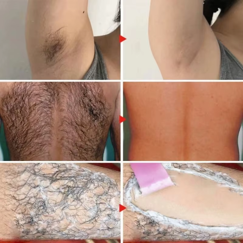 Crème d'épilation permanente