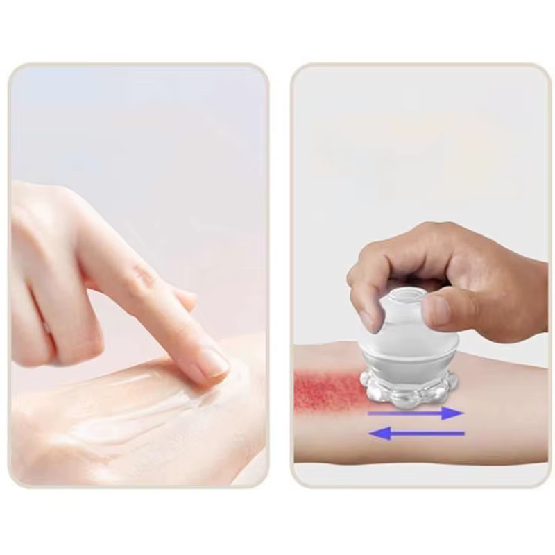 Ventouses de Massage Anti-Cellulite en Silicone