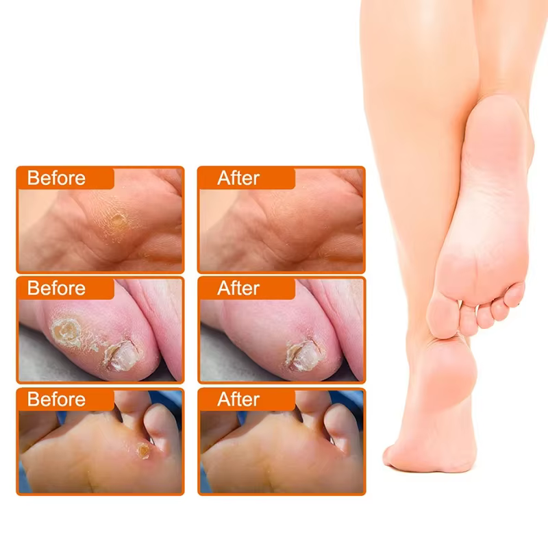 Coussinets de protection des orteils et des pieds