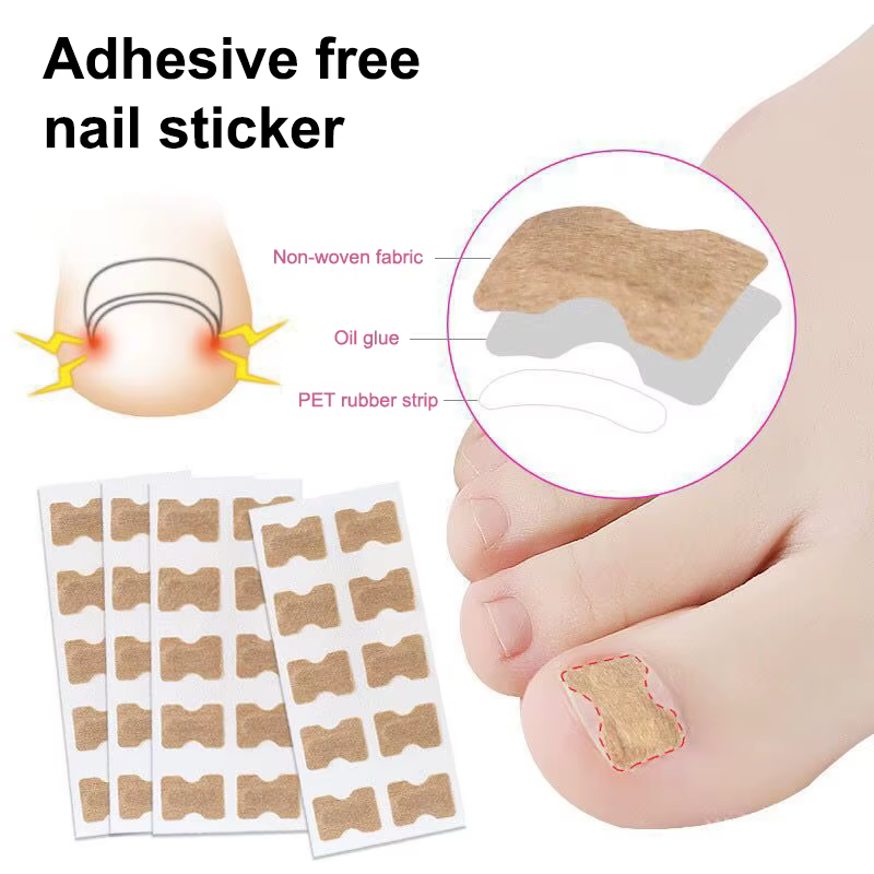 Correcteur professionnel des ongles incarnés – Autocollants de soin des pieds pour la protection