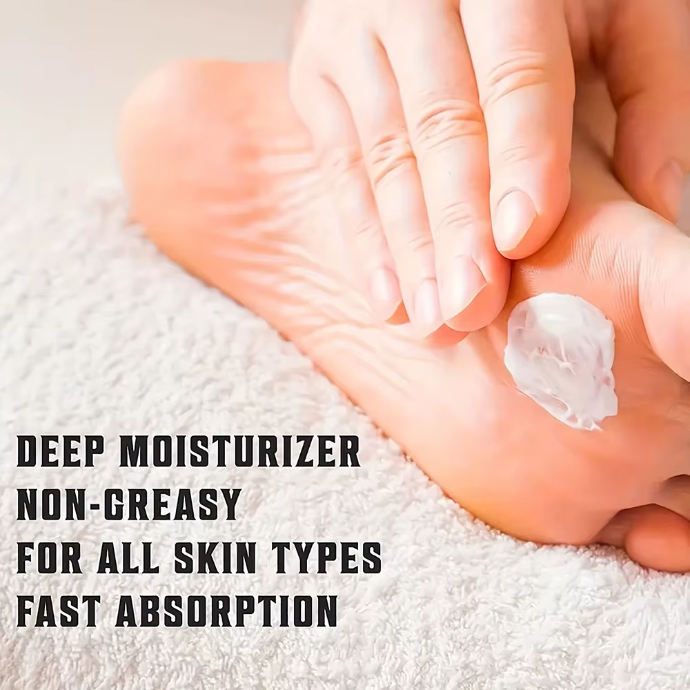 YOUNGCOME Crème pour les pieds pour talons extrêmement secs et craquelés et peaux rugueuses