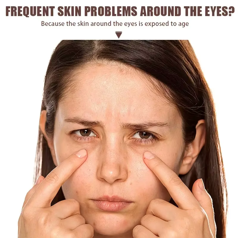 Crème pour les yeux au venin d'abeille et à la caféine pour toute la peau – 20g