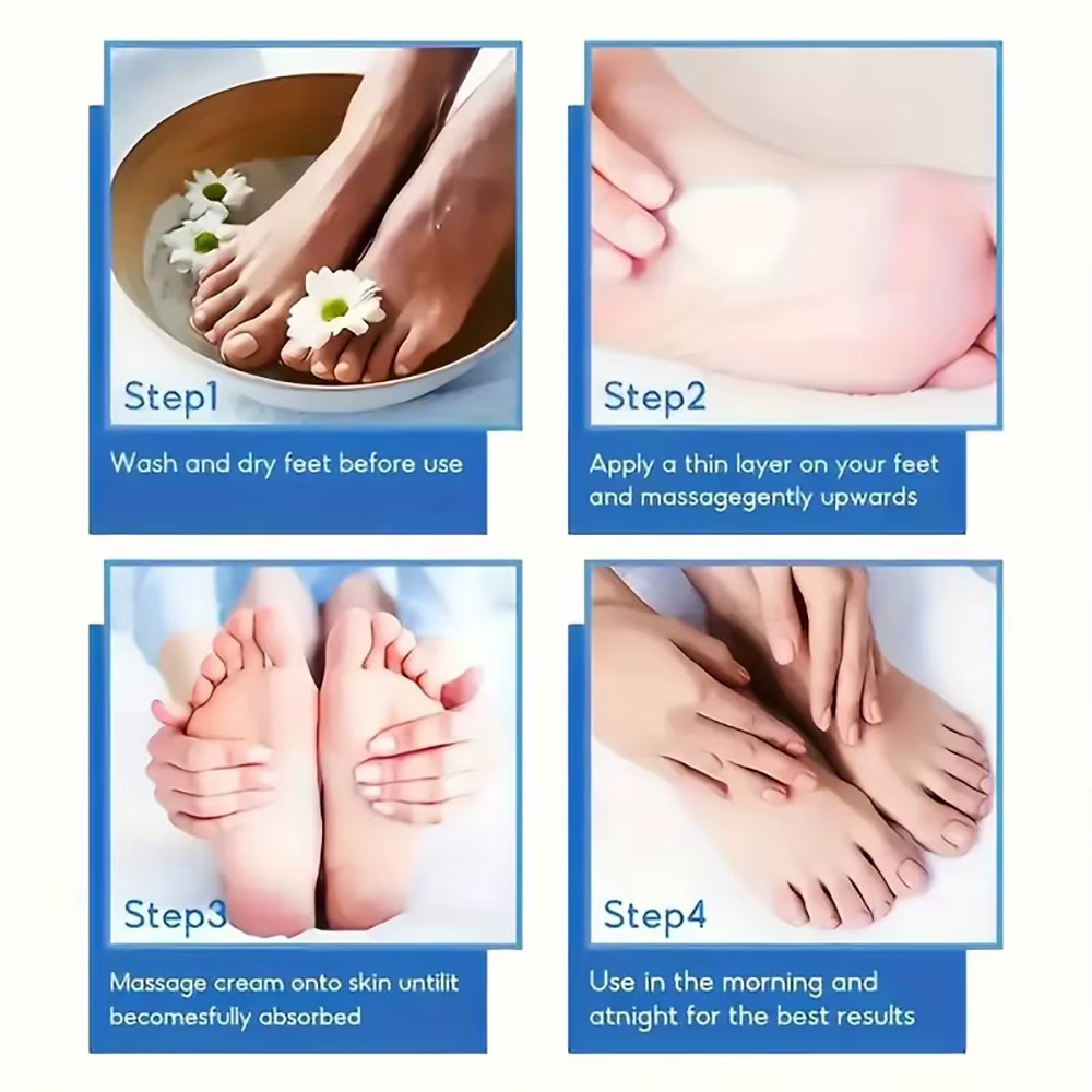 SUYARUN Crème pour les pieds à l'urée 60 % pour talons craquelés et peau sèche - Traitement hydratant intensif
