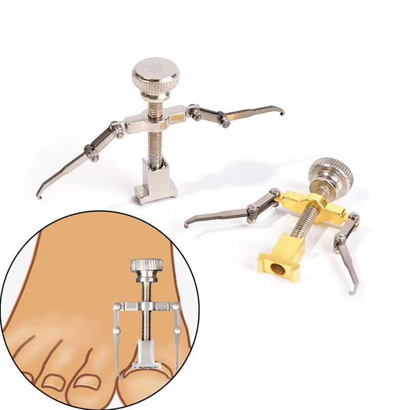 Correction professionnelle des ongles incarnés