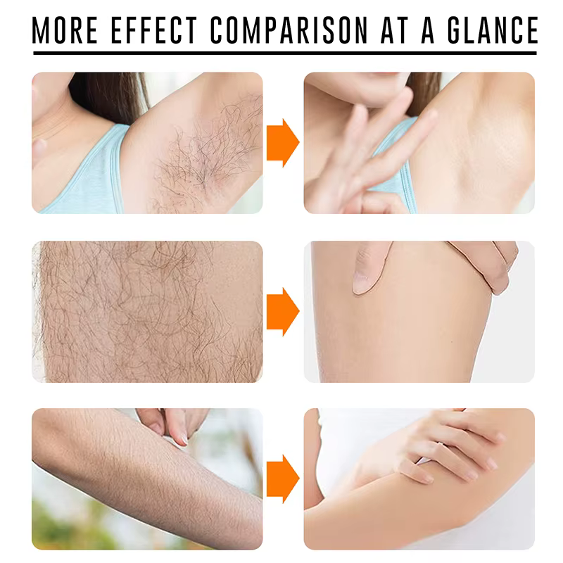 Crème d'épilation permanente indolore parties intimes jambes corps aisselles dépilatoire pour homme femmes blanchissant