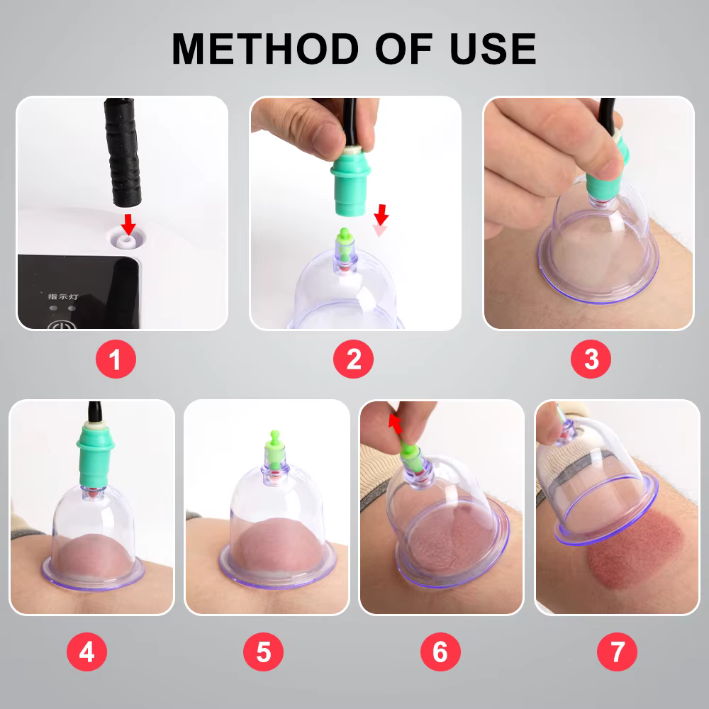 Ventouses électriques sous vide