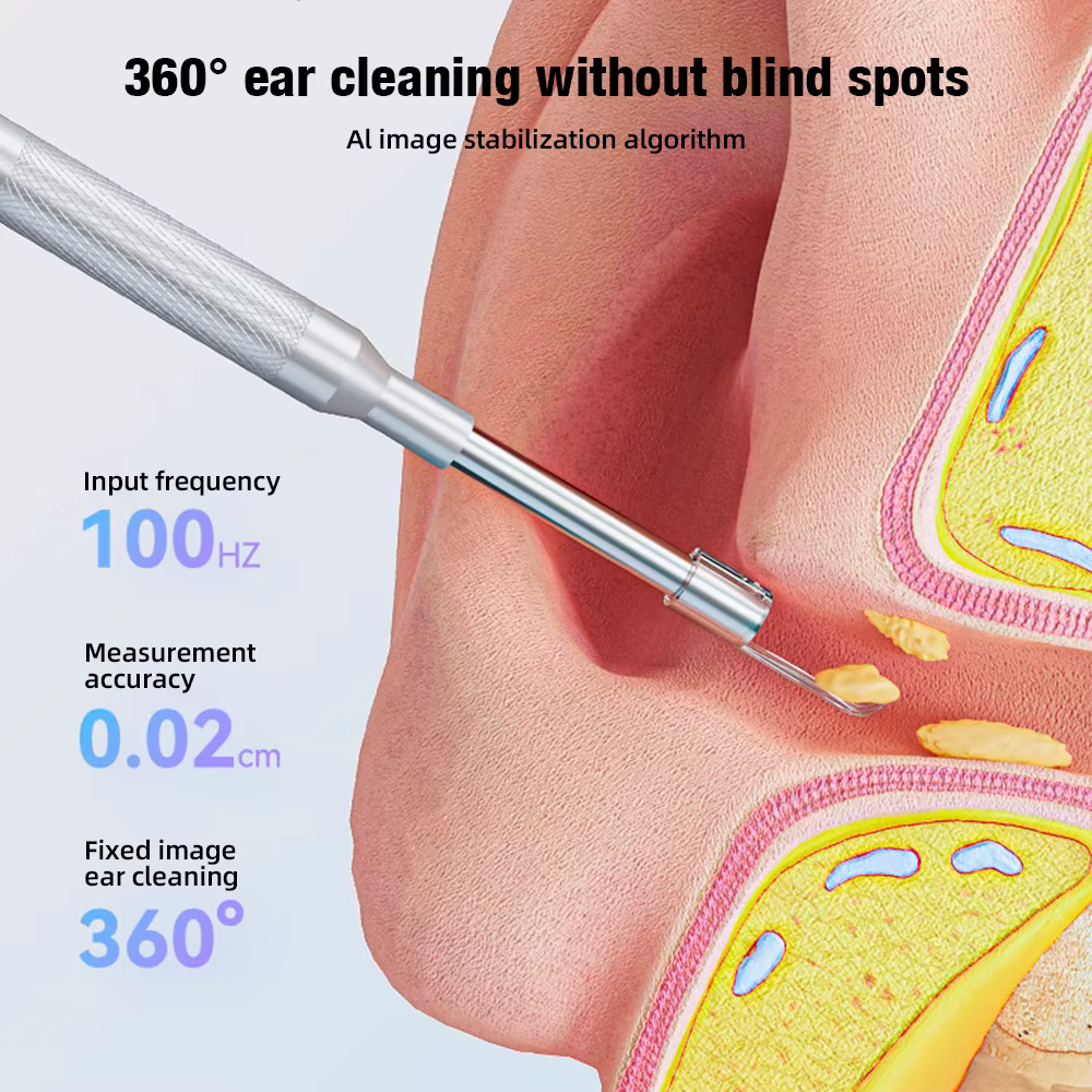 Caméra endoscopique auriculaire, écran LCD 4.3 pouces, Otoscope avec caméra auriculaire légère avec outils d'élimination du cérumen
