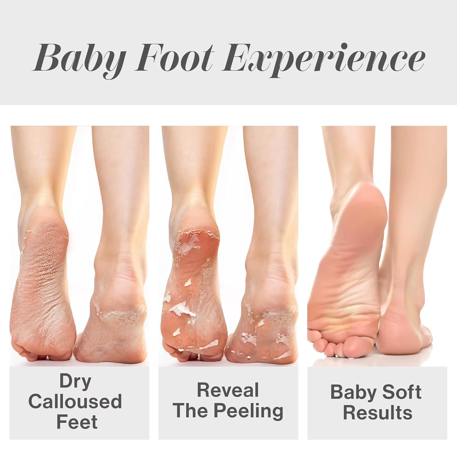 Chaussettes exfoliantes pour les pieds