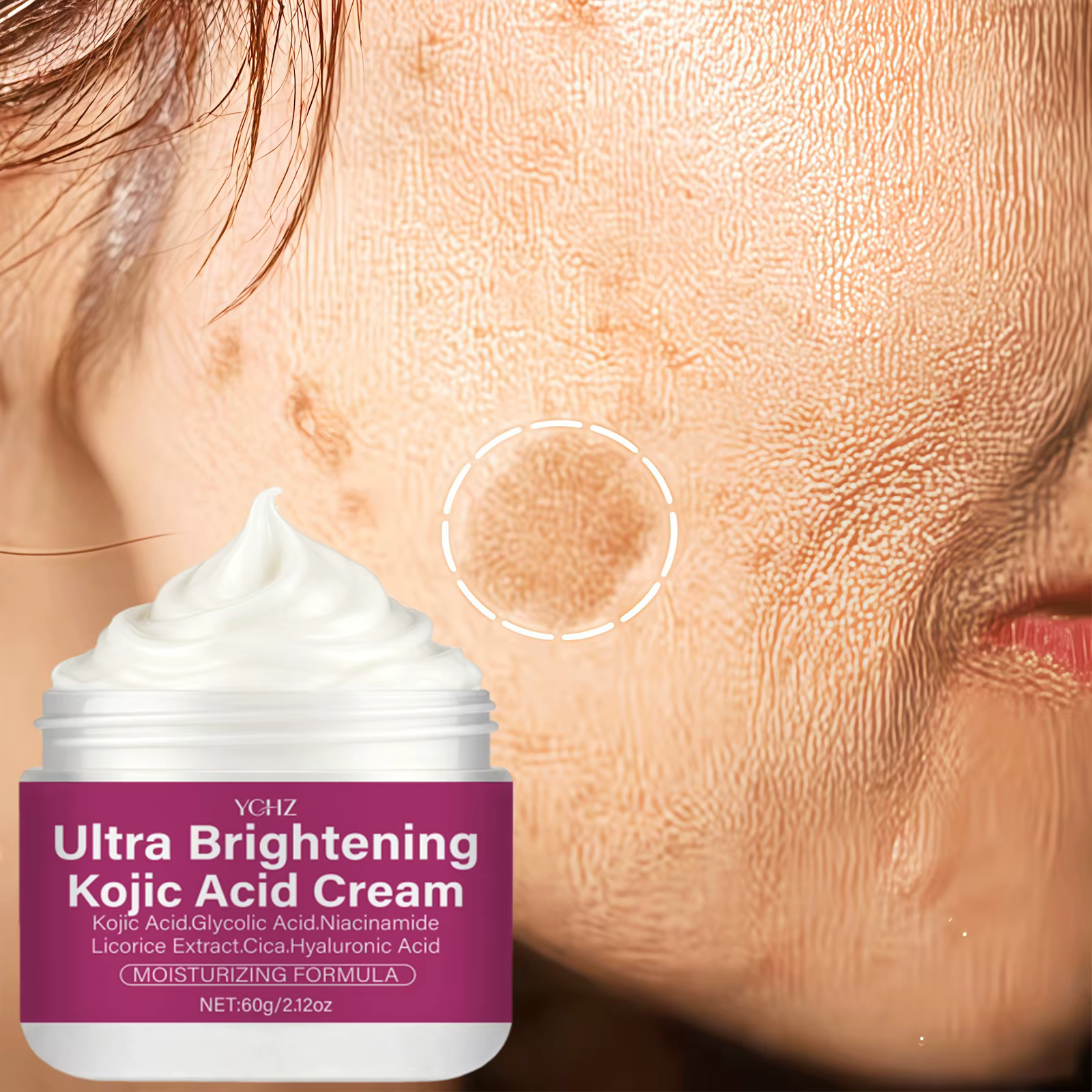 Crème éclaircissante à l'acide kojique contenant de la niacinamide