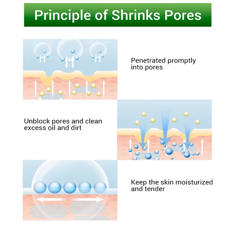 Crème Réductrice de Pores à l'Acide Salicylique