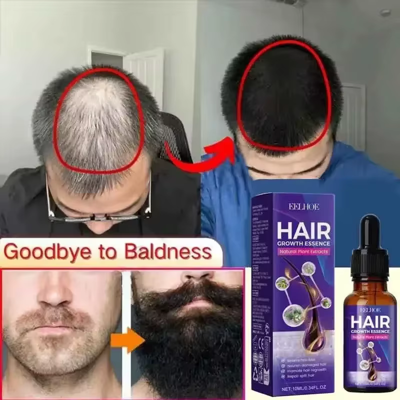 La croissance des cheveux, perte essentielle, traitement de repousse, renforce les cheveux, nourrit le cuir chevelu, léger, Non gras, améliore la Circulation du cuir chevelu